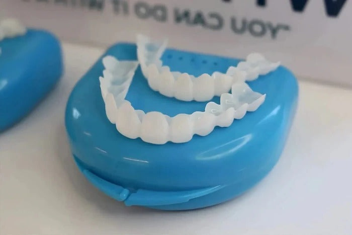 Veneers for Teeth with Natural White Finish